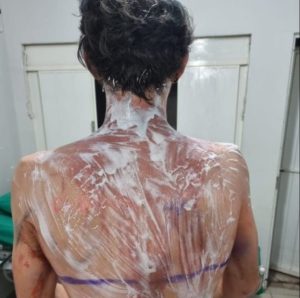 Trote de Medicina Veterinária deixa 25 feridos no Paraná
