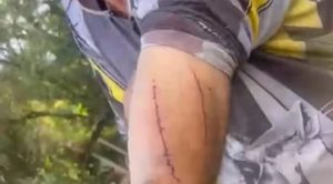 Produtor rural é atacado e dá soco em onça